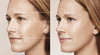 Korektor zmarszczek Korean Secret Wrinkle Filler Relouis